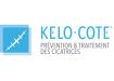 Kelo-Cote